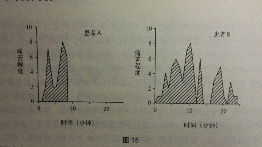 埃奇沃思的手术痛苦实验